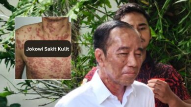 Jokowi Sakit Kulit