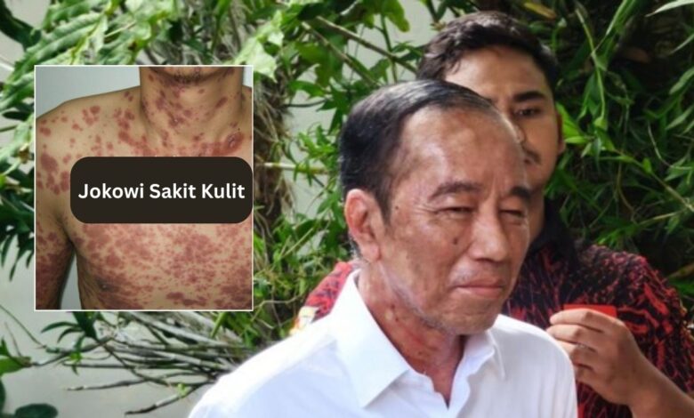 Jokowi Sakit Kulit